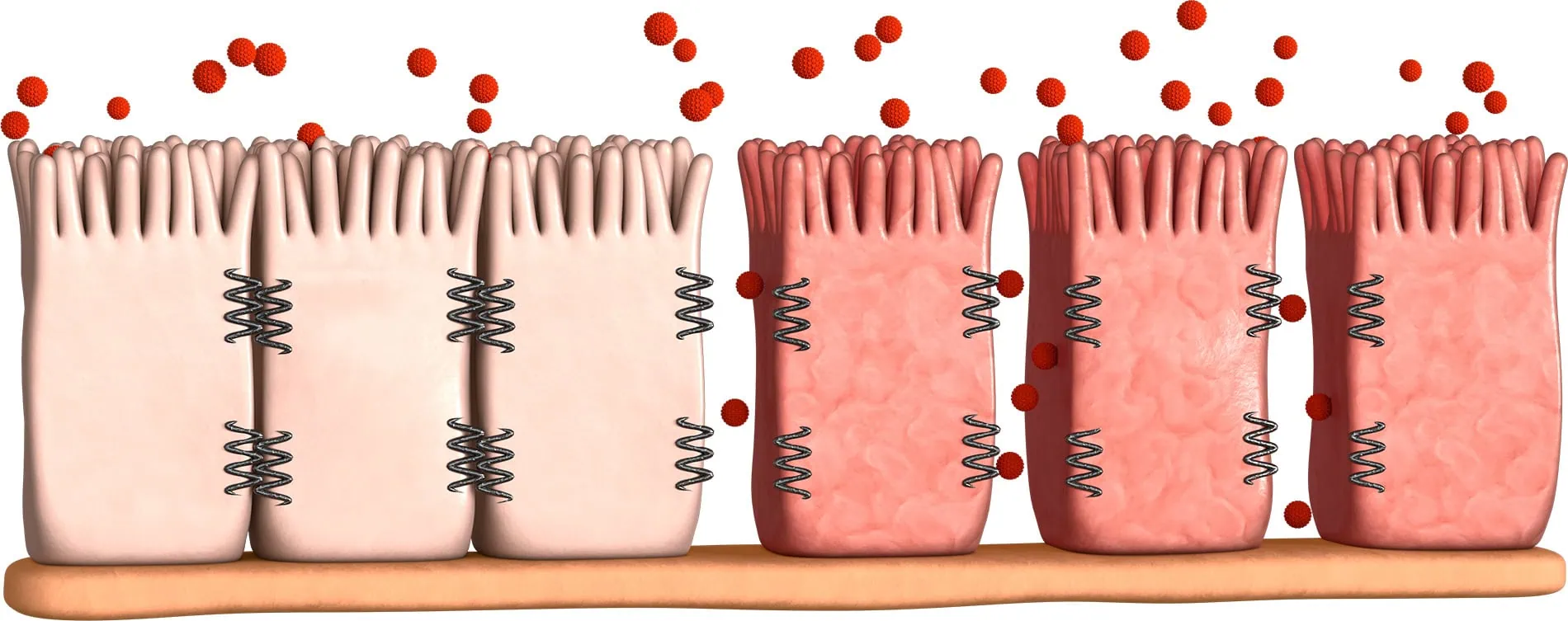 Darmbarriere Schaedigung